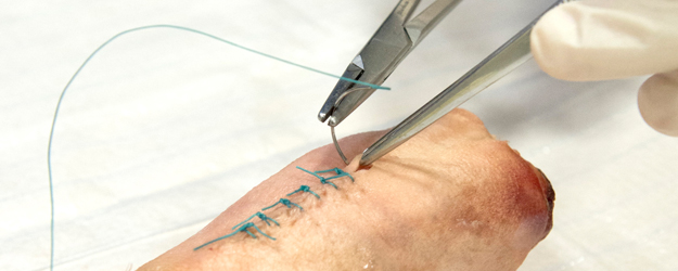 In the suturing course, students practice different techniques – sometimes on pigs' trotters. (photo: Peter Pulkowski)